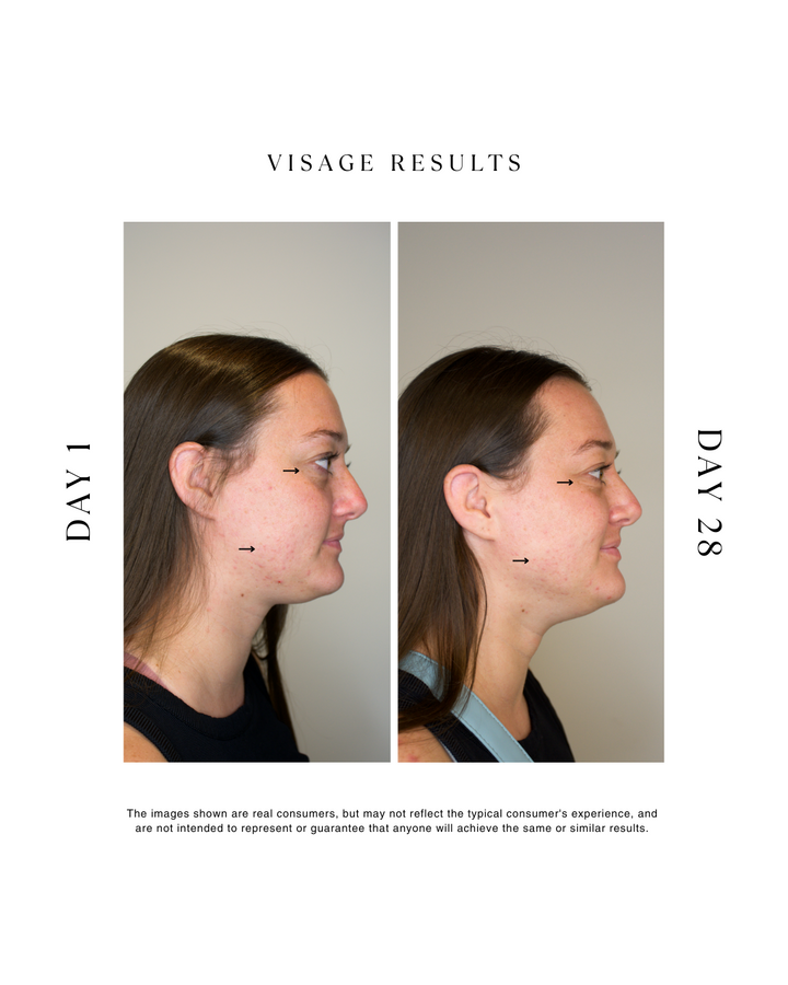 The Visage Collection - Radiant Skin