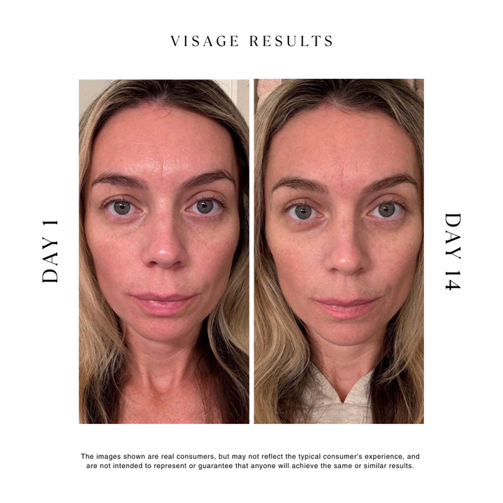The Visage Collection - Radiant Skin
